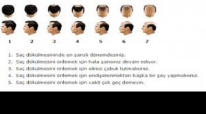 Polislikte Saç Dökülmesi ve Kellik Derecesi Nedir?