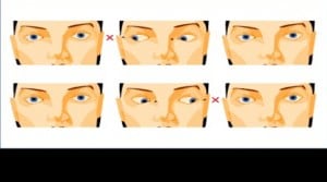 POMEM – PAEM – PÖH Göz Dereceleri Nedir?