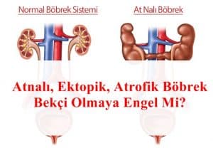 Atnalı, Ektopik, Atrofik Böbrek Bekçi Olmaya Engel Mi?