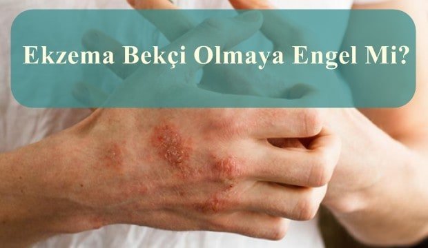 Ekzema Bekçi Olmaya Engel Mi?