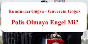 Kunduracı Göğsü – Güvercin Göğüs Polis Olmaya Engel Mi?