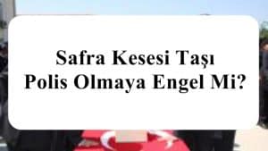 Safra Kesesi Taşı Polis Olmaya Engel Mi?