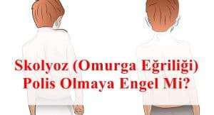 Skolyoz Omurga Eğriliği Polis Olmaya Engel Mi?