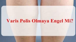 Varis Polis Olmaya Engel Mi?