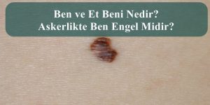 Ben ve Et Beni Nedir? Askerlikte Ben Engel Midir?