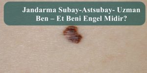 Jandarma Subay-Astsubay- Uzman Ben – Et Beni Engel Midir?