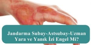 Jandarma Subay-Astsubay-Uzman Yara ve Yanık İzi Engel Mi?