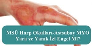 MSÜ Harp Okulları-Astsubay MYO Yara ve Yanık İzi Engel Mi?