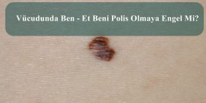 Vücudunda Ben – Et Beni Polis Olmaya Engel Mi?