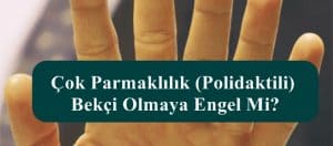 Çok Parmaklılık (Polidaktili) Bekçi Olmaya Engel Mi?