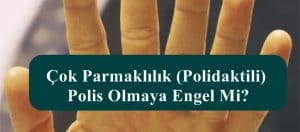 Çok Parmaklılık Polidaktili Polis Olmaya Engel Mi?