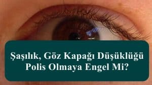 Şaşılık, Göz Kapağı Düşüklüğü Polis Olmaya Engel Mi?