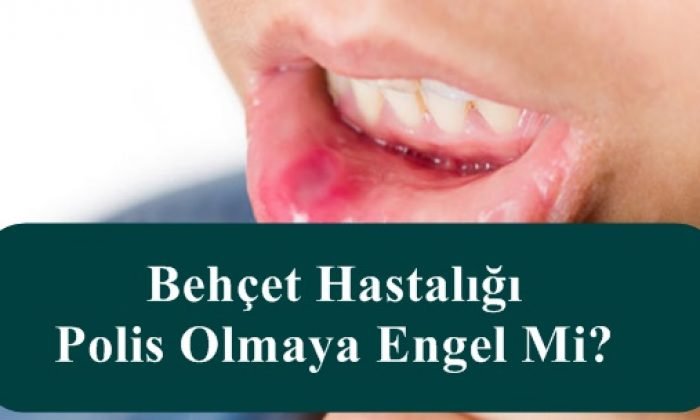 Prof Dr Ahmet Akgul Behcet Hastaligi Ve Tedavisi