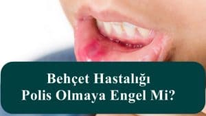 Behçet Hastalığı Polis Olmaya Engel Mi?