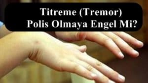El Titremesi – Titreme (Tremor) Polis Olmaya Engel Mi?