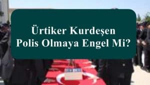 Ürtiker Kurdeşen Polis Olmaya Engel Mi?