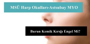 MSÜ Harp Okulları-Astsubay MYO Burun Kemik Kırığı Engel Mi?