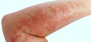 Egzama Harp Okulları – Astsubay MYO Engel Mi?