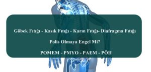 Göbek Fıtığı – Kasık Fıtığı – Karın Fıtığı- Diafragma Fıtığı Polis Olmaya Engel Mi?