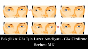 Bekçilikte Göz İçin Lazer Ameliyatı – Göz Çizdirme Serbest Mi?