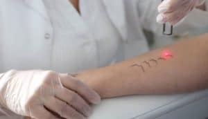 Dikiş – Faça İzi – Jilet İzi Polisliğe Engel Mi ?