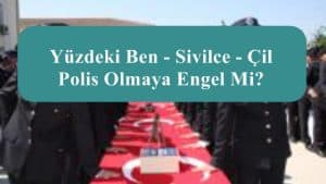 Yüzdeki Ben – Sivilce – Çil  Polis Olmaya Engel Mi?
