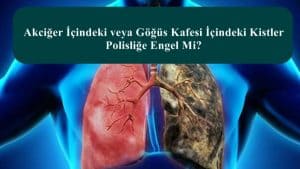 Akciğer İçindeki veya Göğüs Kafesi İçindeki Kistler Polisliğe Engel Mi?