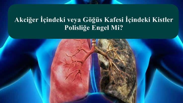 Akciğer İçindeki veya Göğüs Kafesi İçindeki Kistler Polisliğe Engel Mi?