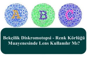 Bekçilik Diskromotopsi – Renk Körlüğü Muayenesinde Lens Kullanılır Mı?