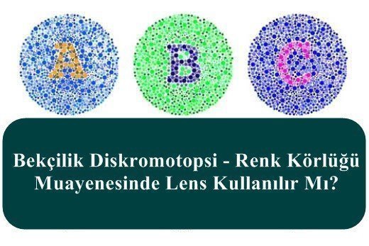 Bekçilik Diskromotopsi – Renk Körlüğü Muayenesinde Lens Kullanılır Mı?
