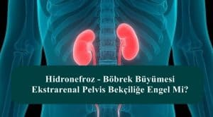 Hidronefroz – Böbrek Büyümesi – Ekstrarenal Pelvis Bekçiliğe Engel Mi?