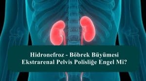 Hidronefroz – Böbrek Büyümesi – Ekstrarenal Pelvis Polisliğe Engel Mi?
