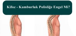 Kifoz – Kamburluk Polisliğe Engel Mi? – POMEM – PÖH – PAEM – PMYO