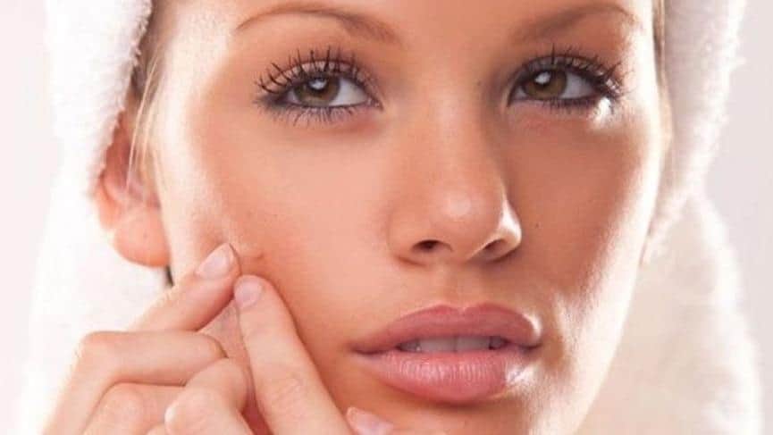 Sivilce Neden Olur? Sivilce Tedavisi Nasıl Olur?