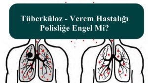 Tüberküloz – Verem Hastalığı Polisliğe Engel Mi?