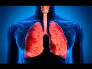 Akciğer Apsesi Nedenleri ve Tedavisi