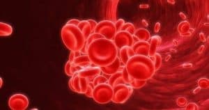 Lösemi Nedir Belirtileri ve Tedavisi