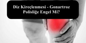 Diz Kireçlenmesi – Gonartroz Polisliğe Engel Mi?