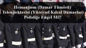 Hemanjiom (Damar Tümörü) – Telenjiektazisi (Yüzeysel Kılcal Damarlar) Polisliğe Engel Mi?