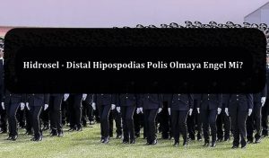 Hidrosel – Distal Hipospodias Polis Olmaya Engel Mi?