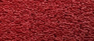 Polistemi, Lökositoz, Trombositoz Bekçi Olmaya Engel Mi?