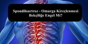Spondiloartroz – Omurga Kireçlenmesi Bekçiliğe Engel Mi?