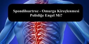 Spondiloartroz – Omurga Kireçlenmesi Polisliğe Engel Mi?