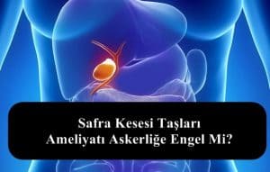 Safra Kesesi Taşları – Ameliyatı Askerliğe Engel Mi?