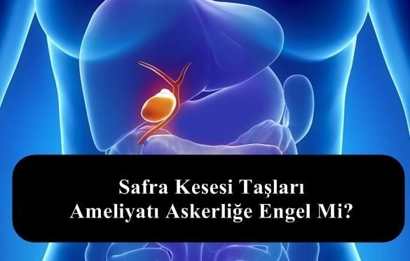 Safra Kesesi Taşları – Ameliyatı Askerliğe Engel Mi?