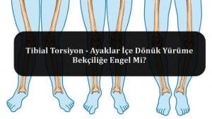 Tibial Torsiyon – Ayaklar İçe Dönük Yürüme Bekçiliğe Engel Mi?