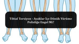 Tibial Torsiyon – Ayaklar İçe Dönük Yürüme Polisliğe Engel Mi?