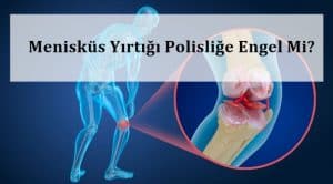 Menisküs Yırtığı Polisliğe Engel Mi? – Menisküs Yırtığı Ameliyatı
