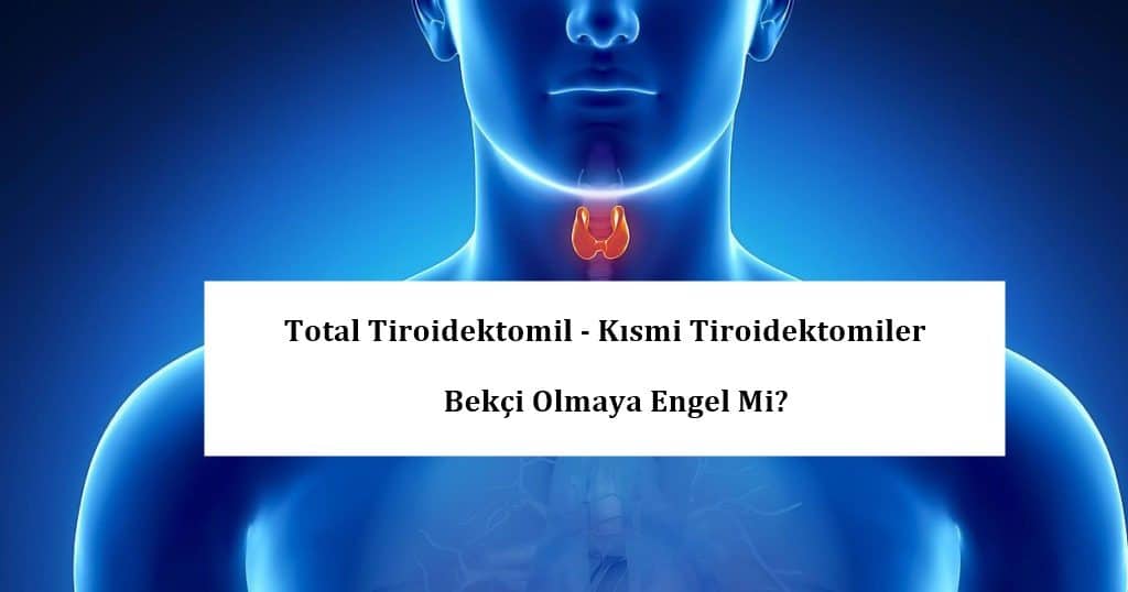 Total Tiroidektomil Kismi Tiroidektomiler Bekci Olmaya Engel Mi