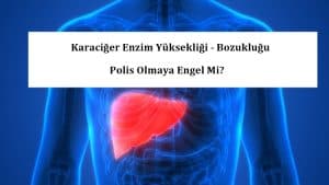 Karaciğer Enzim Yüksekliği – Bozukluğu Polis Olmaya Engel Mi?